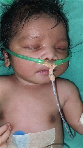 so cute baby o2 fix nicu #shortsfeed #newbornbaby #cutevideo #cute #shorts #baby #nursing #gnm #fyp