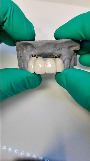 How to fix missing front teeth