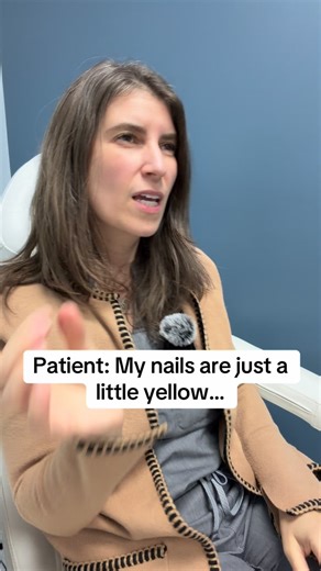 Let’s talk about Onychomycosis (Fungal Nails) Thick, yellow, crumbly toenails are one of the most common things we see in clinic — and most of the time, it’s not “just aging”… it’s a fungal infection. 👉 What is Onychomycosis? A fungal infection of the toenail that slowly invades the nail bed, making the nail thick, discolored, brittle, and sometimes painful. It can affect one nail or multiple and usually progresses over time if untreated. How Do We Diagnose It? A proper diagnosis is key because