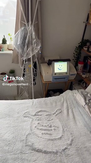 Step-by-Step Peritoneal Dialysis Machine Setup Guide