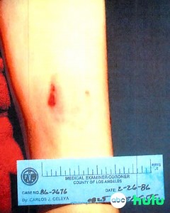 405K views · 3K reactions | TONIGHT: One of most sensational true crime stories. A brutal murder and a shocking twist nobody could have ever imagined. The all-new #ABC2020 ‘The Killer Down the Hall’ premieres tonight at 9/8c on ABC – and stream on Hulu. | ABC 20/20 | Facebook