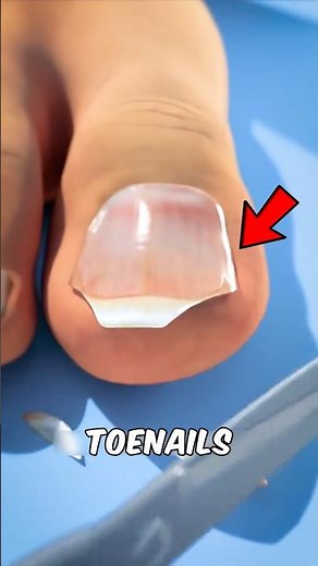 DON’T Cut Your Toenails Like This 😳