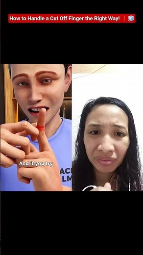 How to Handle a Cut Off Finger the Right Way! ❗🧊