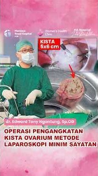Operasi Pengangkatan Kista Dermoid Ovarium Metode Laparoskopi | RS Mandaya | dr. Edward, Sp.OG
