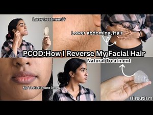 PCOD:How I Reverse facial Hair[Hirsutism]!!Natural treatment!!