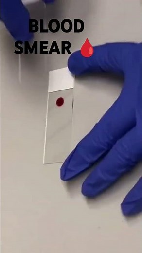 Blood Smear Examination: Understanding Blood Cells Under the Microscope 🩸👨‍🔬🧪