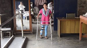 14K views · 439 reactions | Dr. Mathew Varghese treats polio...