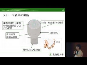 Living well with a stoma - Miyuki Hayashi