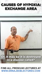 Causes Of Hypoxia Exchange Area This Reel is a clip from the lecture "Hypoxia Part 1" To watch this complete lecture please visit our website. 👇🏻👇🏻👇🏻 www.drnajeeblectures.com If you Sign Up Now you can get lifetime access to our premium lectures for just $45 ONLY. So hurry up and sign up now. The link is below. 👇🏻👇🏻👇🏻👇🏻👇🏻👇🏻👇🏻👇🏻👇🏻 https://members.drnajeeblectures.com/courses/Dr-Najeeb-Lectures-64b6a71fe4b07805c2a499c2-64b6a71fe4b07805c2a499c2 | Dr. Najeeb