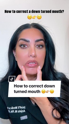 DAO Botox ( Depressor anguli oris) muscle is responsible for pulling the corner of mouth down. Injecting botox into this muscle relaxes the muscle in an upward direction to give you a slight lift in the corner of your mouth. -4 to 6 units of Botox -Last 3-4 months #daomusclebotox #frownlines #fyp #botox #aestheticnurse #pasadena #botoxinjection #naturalbeauty #marrionette