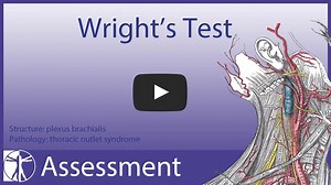 1K views · 28 reactions | THORACIC OUTLET SYNDROME ASSESSMENT SERIES...