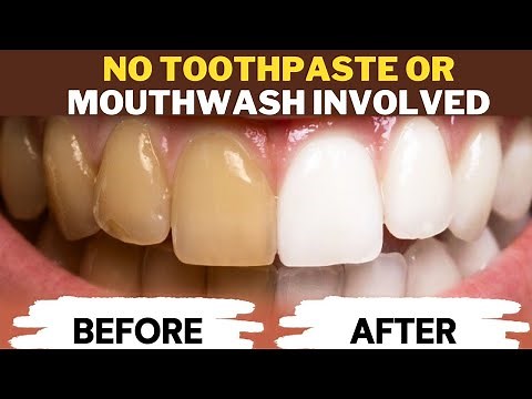 Let This Soft Mineral Melt In Your Mouth To Rebuild Gums and Teeth