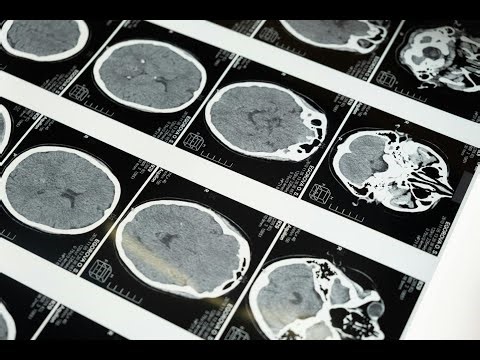 Is Havana Syndrome Proof of a Secret Weapons Program — Or Something Worse?