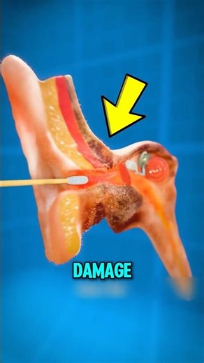 What If You Keep Using Q-Tips? 👂😨