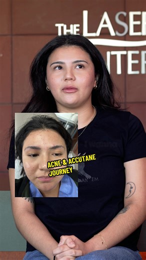 “I was scared to try Accutane… but I had already tried everything else.” Nayeli gets real about her acne journey—from over-the-counter products and home remedies to finally starting Accutane. Her skin is clearer now, and she’s excited to focus on healing the scars and smoothing out texture next with lasers. This is just one person’s story, shared with love. 💛 **Accutane is a prescription medication and should always be taken under medical supervision. To get started with your journey, give us a