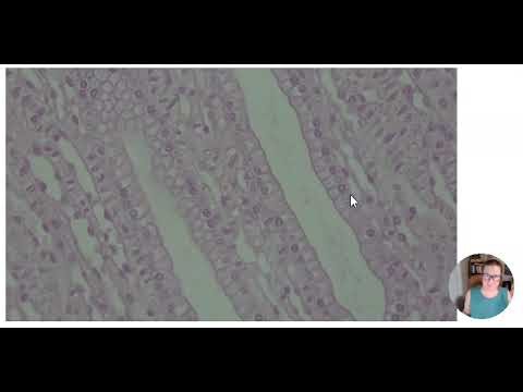 Anatomy Lab v2.0 Unit 1: Histology - Simple Columnar Epithelium
