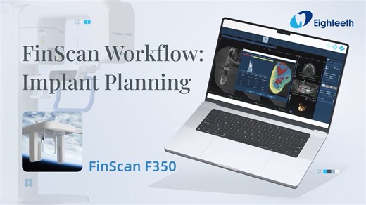 𝐅𝐢𝐧𝐒𝐜𝐚𝐧 𝐖𝐨𝐫𝐤𝐟𝐥𝐨𝐰: 𝐈𝐦𝐩𝐥𝐚𝐧𝐭 𝐏𝐥𝐚𝐧𝐧𝐢𝐧𝐠 How to plan implants with FinScan? Watch the full workflow and see how our CBCT software makes pre-implant planning fast, intuitive, and predictable. With FinScan, from scan → planning → confidence! #Eighteeth #FinScan #CBCT #ImplantPlanning #DigitalDentistry #Workflow | Eighteeth Medical