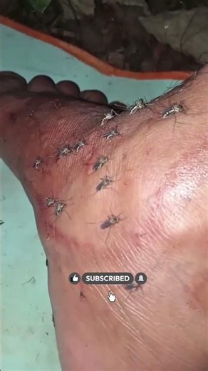 US biggest mosquitoes