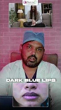 Why Do Lips Turn Dark? | Doctor Explains Causes & Solutions | Dr. Nagaraju | #darklips