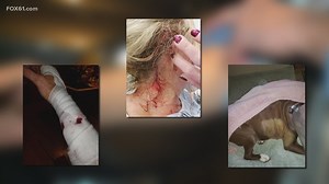 Couple attacked by rabid bobcat speaks out