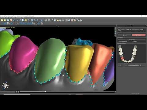 Exporting Aligner STL Files For Print