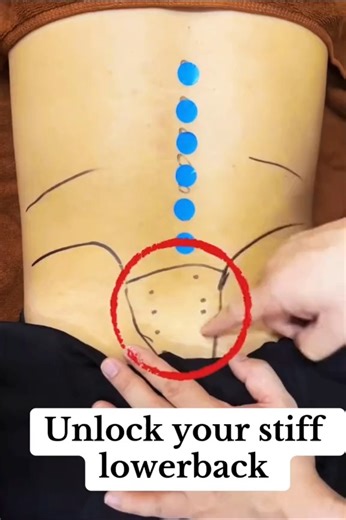 10K views · 95 reactions | Unlock your stiff lower back. #massage #massagetherapy #lowerback #lowerbackpain #lowerbackpainrelief | Back Pain Treatment | Facebook
