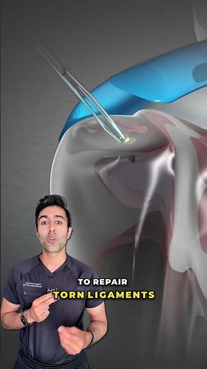 How Surgeons Repair Shoulder Injuries Without Large Incisions