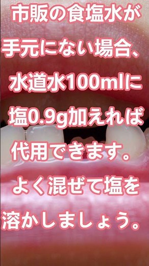 [緊急]歯が欠けた・歯が抜けた時の対処方法