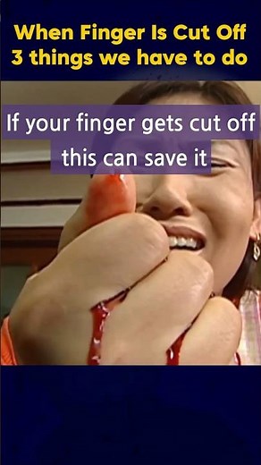 When a Finger Is Cut Off Emergency Response l tips for life