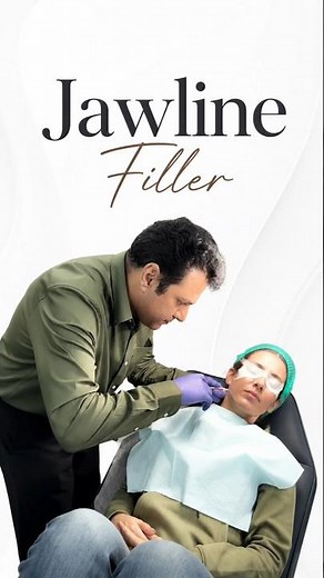 The Ultimate Jawline Transformation - Jawline Filler