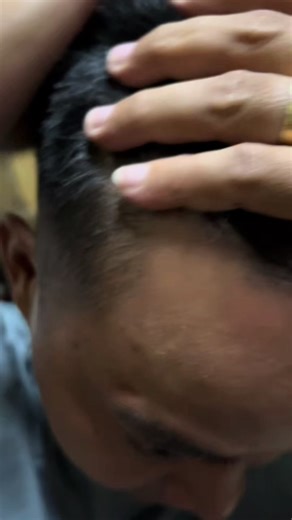 Coconut Oil Shampoo for Effective Anti-Dandruff Treatment