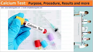 Ionized Calcium | Lab Tests Guide