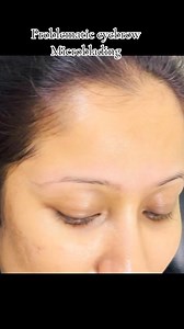 Problematic eyebrow Microblading🌸🌸 | Anee’s Extensions And Makeover Studio
