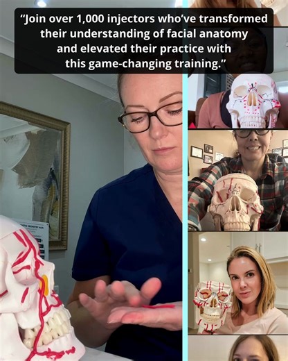 "I don't know the exact depth of vessels in this area." "What if their anatomy doesn't match what I learned in training?" "What if this bruise is actually a VO?" If these thoughts sound familiar, you're not alone. 💉 Over 1,398 injectors have already made the switch from flat textbook diagrams to Dr Tim Pearce's 3D Vision Method - and they're never going back. The Anatomy360 course teaches you to see facial anatomy with crystal-clear precision. Every vessel. Every nerve. Every danger zone. Every