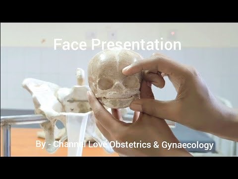 Face Presentation- Labour Mechanism & Management ‪@Love_Obs_Gynae‬
