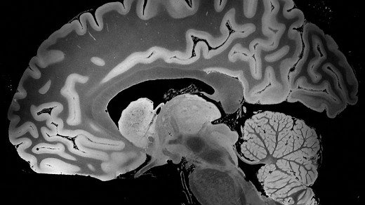 The entire human brain in 'unprecedented' detail, thanks to powerful MRI