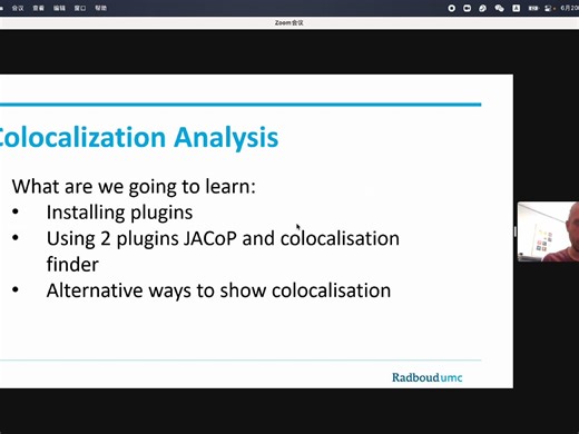 Fiji ImageJ course: presentation 4 - colocalization