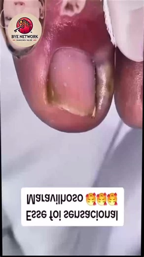 183. Oatmeal baths to calm skin and scalp discomfort #SkinWellness #HairWellness #NaturalOptions | Bye