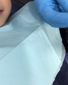 1.8K views · 41 reactions | Placing GI strip crowns . I told some of...