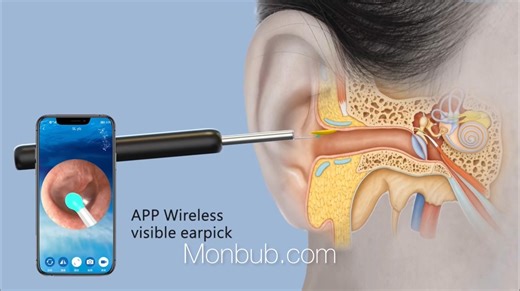 3K views · 23 reactions | Wireless Smart Visual Ear Cleaner Otoscope NE7 Ear Wax Removal Tool with Camera Ear Endoscope 1080P Kit for iPhone iPad Android | Dale Campeón | Facebook