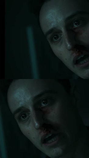 Bloody Nose Mystery: Is Your Computer Making You Bleed? #shorts