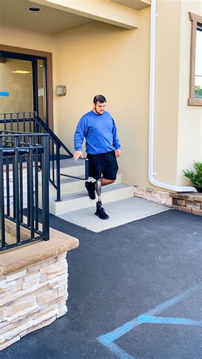 2.2K reactions · 41 shares | Just wait for the transformation!  James first came to us in 2020 as a 14-year-old, newly above-knee amputee after losing his leg to osteosarcoma. From taking his first steps in a prosthesis to now walking confidently with his new X4 microprocessor knee!✨樂 #prostheticleg | A Step Ahead Prosthetics | Facebook