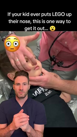 90K views · 413 reactions | mother's kiss technique is a simple and effective method used to remove a foreign body from a child's nose. It in #reels #reelsfb | Jonh Andrew | Facebook