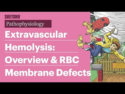 Extravascular Hemolysis & RBC Defects: Pathophysiology (Part 1) | Sketchy Medical | USMLE Step 1
