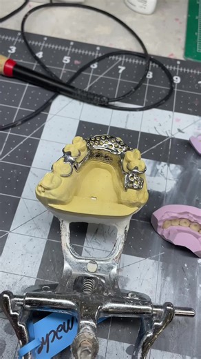 Proceso y finalización de parciales dentales