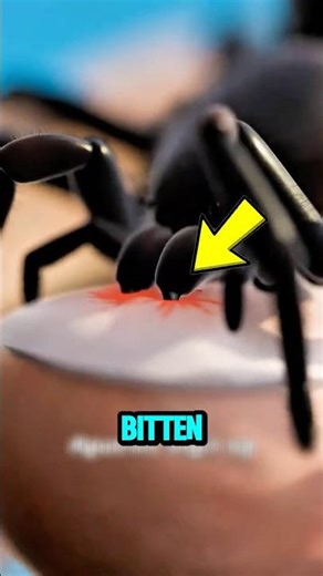 Bitten by a Spider? Here’s What You Should REALLY Do 🕷️