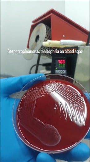 Stenotrophomonas maltophilia on blood agar #microbiology #culture #trending #viral
