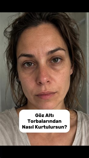 Göz altı torbalarının en yaygın nedenlerinden birinin lenfatik sıvı birikmesi olduğunu biliyor muydunuz? 🤔 Küçük ama doğru dokunuşlarla bu ödemi dağıtmak ve daha aydınlık bir bakışa sahip olmak mümkün. Çok daha fazlasını öğreneceğiniz ve uygulayacağınız Hande hoca ile Yüz yogası derslerimiz 10 Mart’ta (yarın) başlıyor. Detaylar ve kayıt için: ✅ Profildeki linke tıklayın. ✅ Veya yorumlara “YÜZ” yazın ve detaylar için özel mesaj kutunuzu kontrol edin! ✨