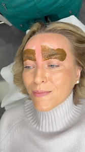 Microblading eyebrow reveal 🤞 “How have you done that!!” Treatment: Microblading 🎯 Purpose: To add shape fullness and definition. 👓 How it works: Using a hand held tool I carefully implant pigment just under the epidermis creating life like realism hair strokes. 🎉 Results: Immediate ✏ Note: Individual results may vary. 📞 Phone: 07455092442 📬 Email: Enquiries@bellefemmeacademy.com 📍 Location: Shirley, West Midlands 👏 Technique: Hand held Microblading 😴 Anesthesia: Anaesthetic cream. ⏰ Ti