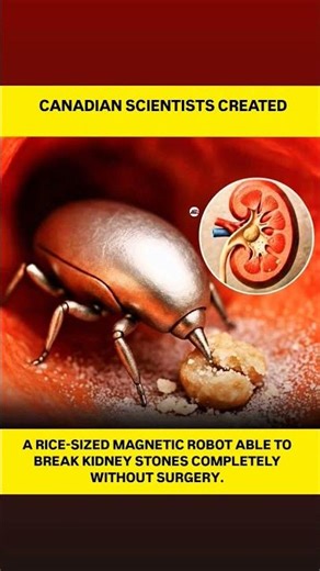 "University of Waterloo Team Develops Non-Invasive Kidney Stone Treatment Using Micro-Robots"